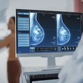 Впервые искусственный интеллект точно диагностирует рак молочной железы